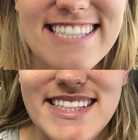 Before & After White Lotus Medical Aesthetics