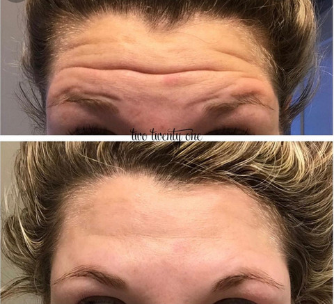 Before & After White Lotus Medical Aesthetics