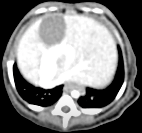CTA of dog with intrahepatic portosystemic shunt