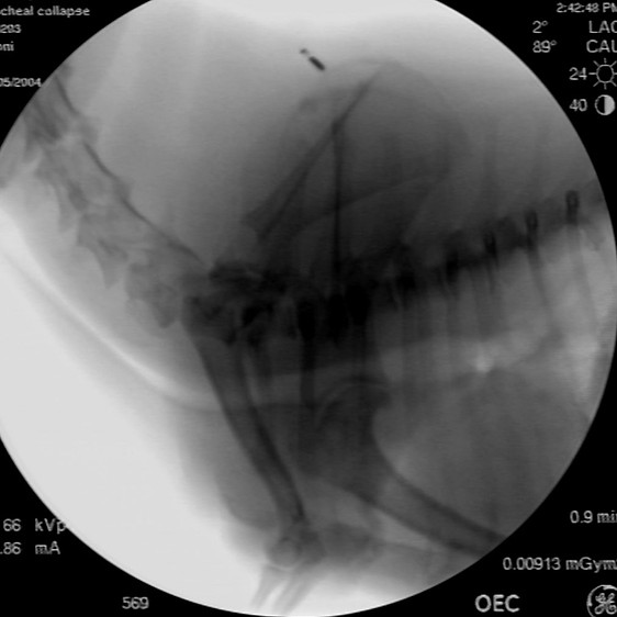 Tracheal collapse