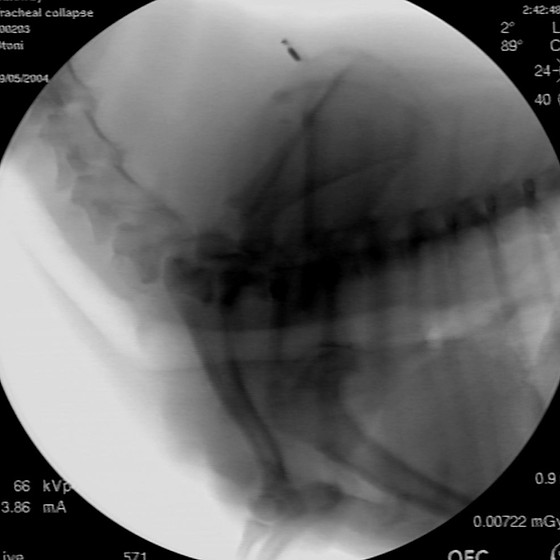 Tracheal collapse