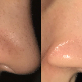 CURSO DERMAFACE 4.png