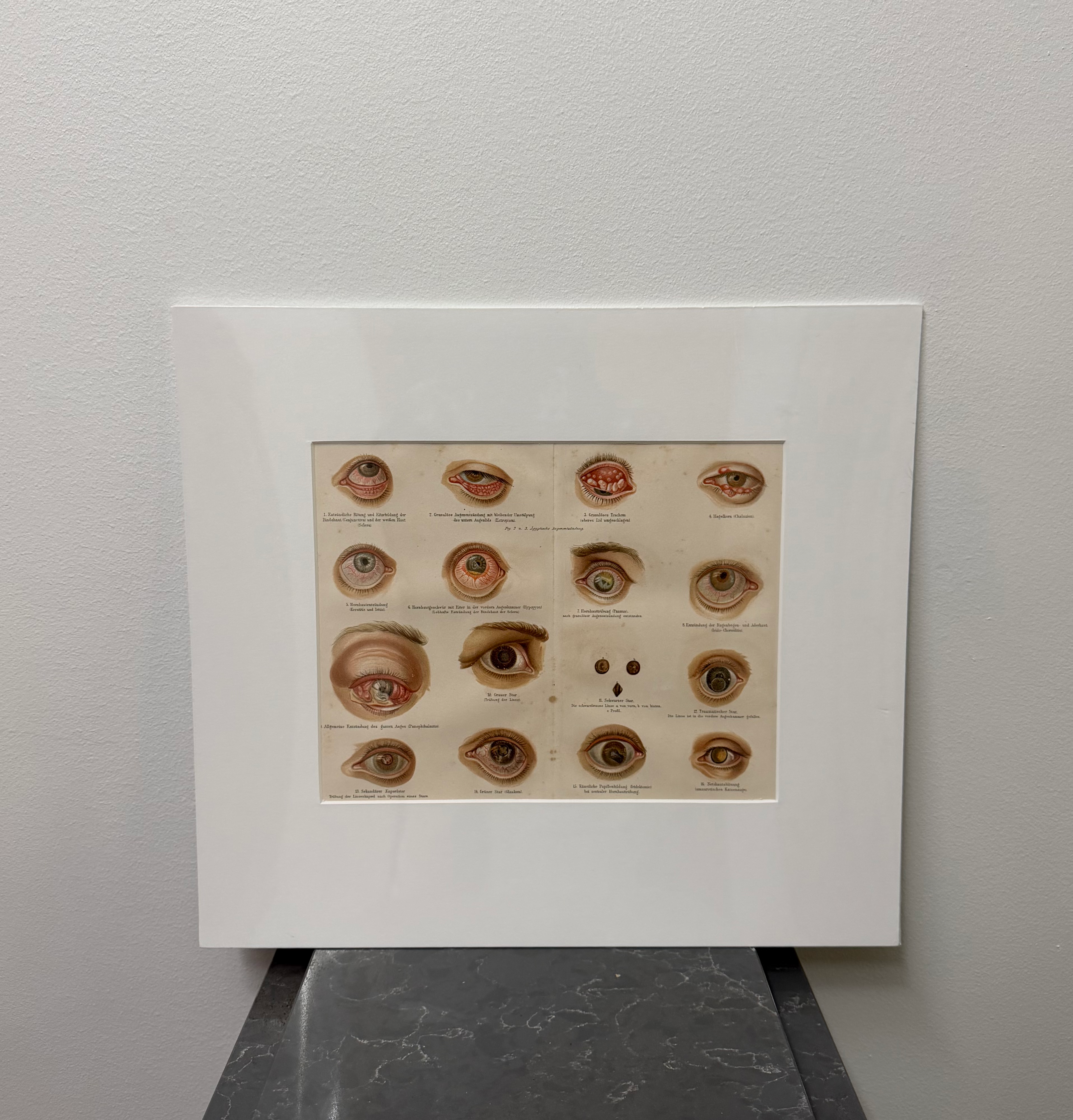 Eye Diseases (late 19th century)