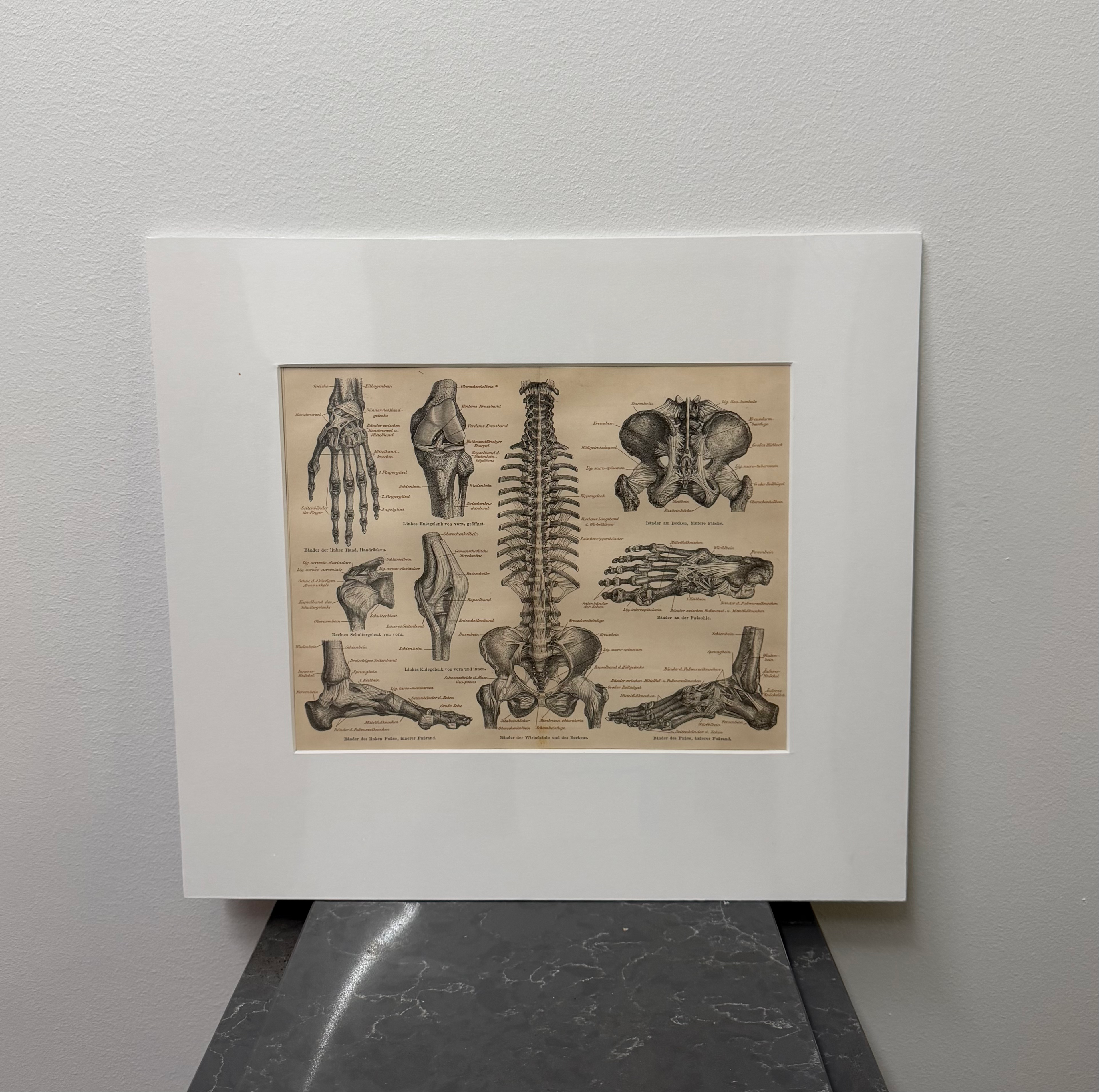 Tendons (late 19th century)