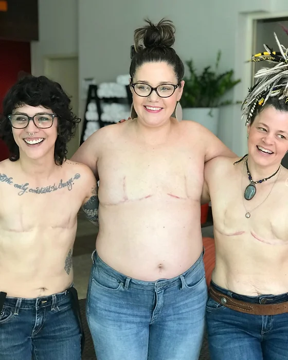Double mastectomy flat closure clearance