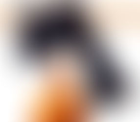 10 Facts You Need to Know About Alopecia and Those Who Live With It