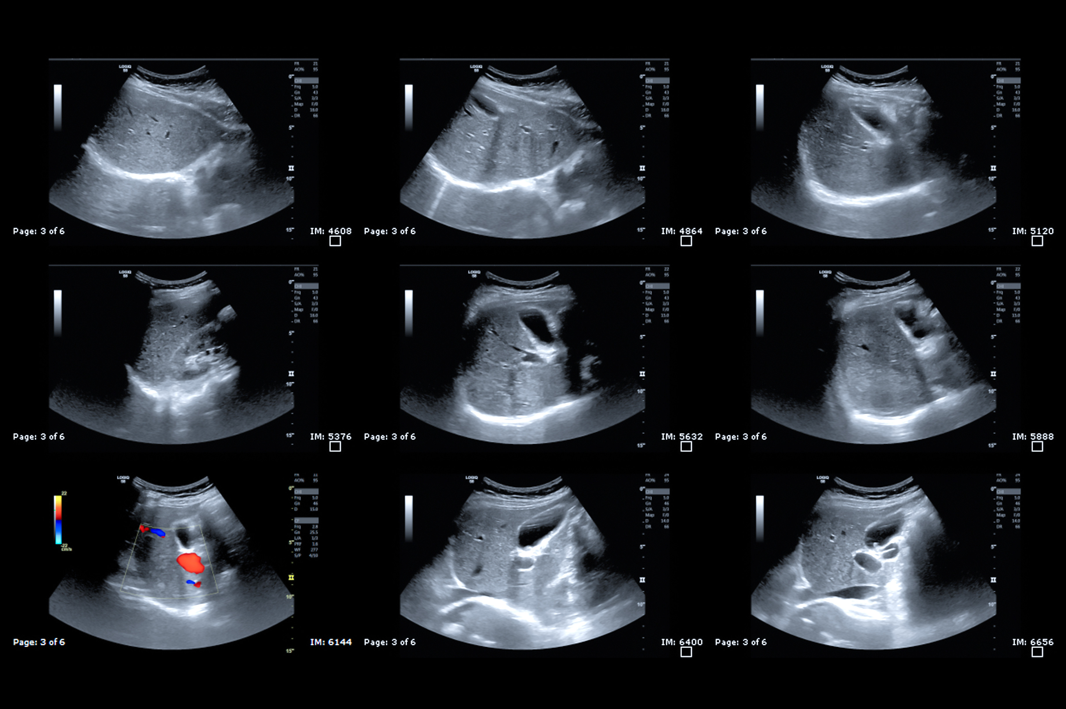 Echo endoscopie Toulouse Centre Des Maladies De L Appareil Digestif Echo endoscopie Toulouse Centre Des Maladies De L Appareil Digestif