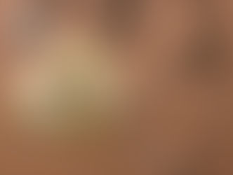 What is Truly Contributing to the Rising Costs of Medical Supply Manufacturing?