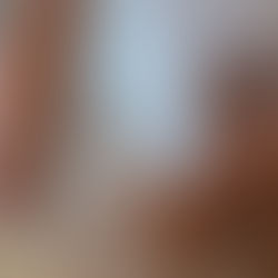 Drainage lymphatique par Virginie Kermeur