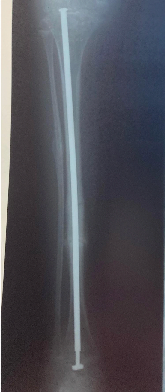 Screenshot 2023-07-17 at 1.09.27 PM.png