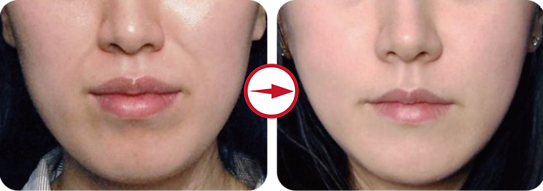 C 셀온스킨줄기세포배양액 Cellonkin