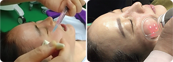 레이저-1.png