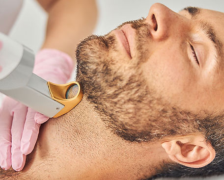 laser hair removal.JPG