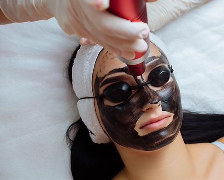 Carbon Laser Peel Facial.jpg
