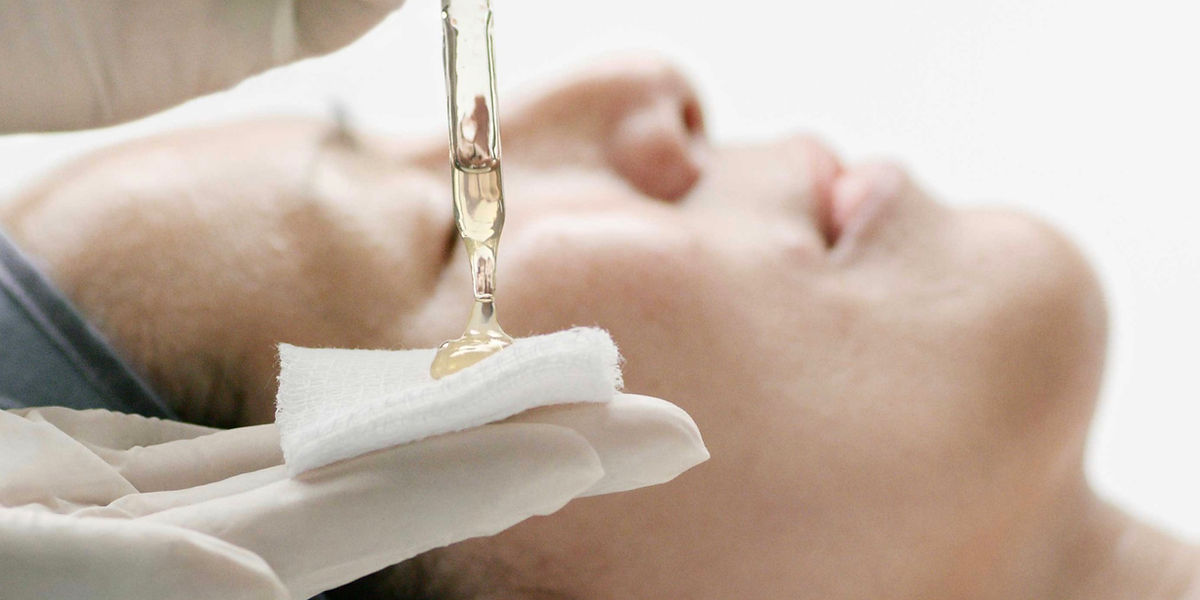 chemical peel.PNG