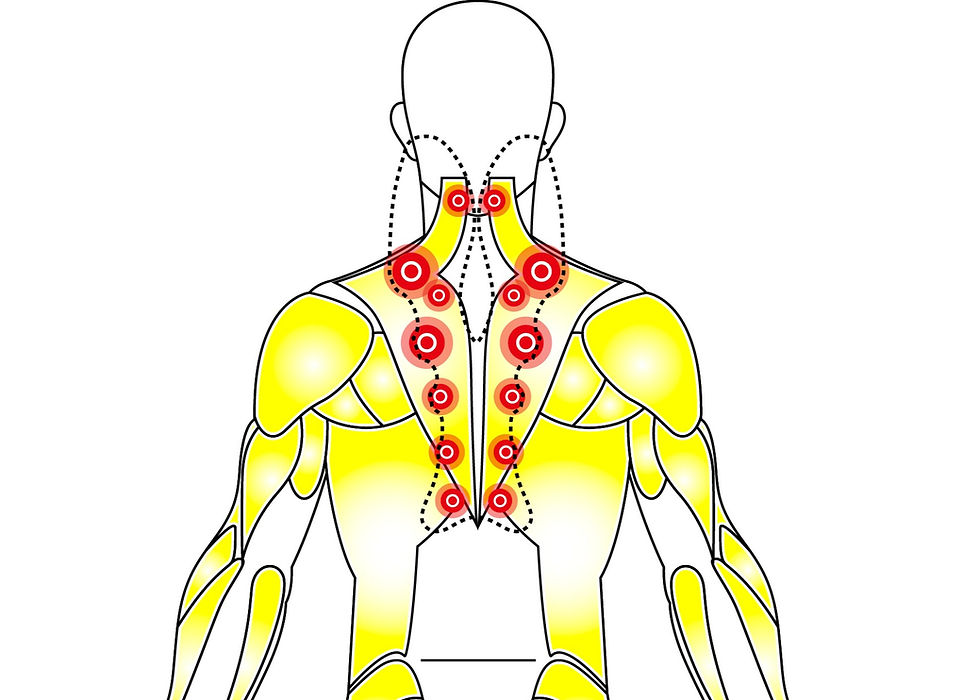 How to Massage Trapezius Muscle to Relieve Neck & Shoulder Pain and