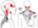 How to Relieve Occipital Neuralgia