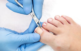Footworks Podiatry Nail Care Corns Callus
