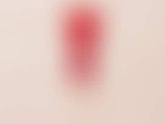 Is my bleeding normal?