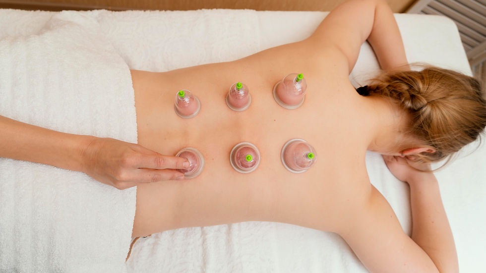 servicio de terapia con cupping o ventosas