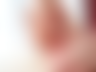 Discover the Benefits of Dry Needling: A Powerful Treatment Option