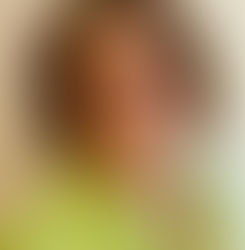 No-Sweat Summer Survival Tips for Parents of Young Campers with Hearing Loss