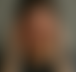 Spanningshoofdpijn, wat een last!