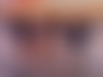 Laser Hair Removal Basics: What You Really Need to Know