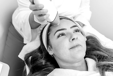 RF Microneedling_edited.jpg