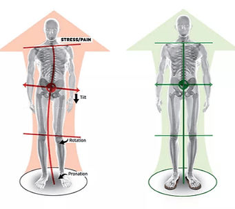 footlevelers-pronation_edited.jpg
