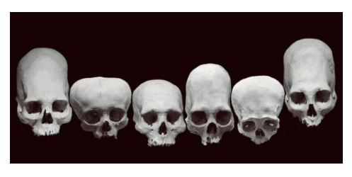 Row of skulls showing the different shapes attained through cranial modification..