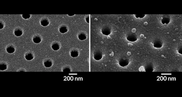 Biotech Patent News: Novo teste aperfeiçoa diagnóstico de câncer de pâncreas