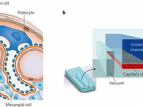 Biotech Patent News: Hemodiálise em chip de computador