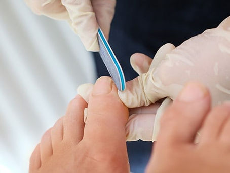 Mobile Foot Care Services in Brampton, ON – Professional In-Home Treatment You Can Trust