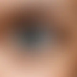 How Can Natural Eye Health Remedies Unlock the Secret to Crystal Clear Vision?