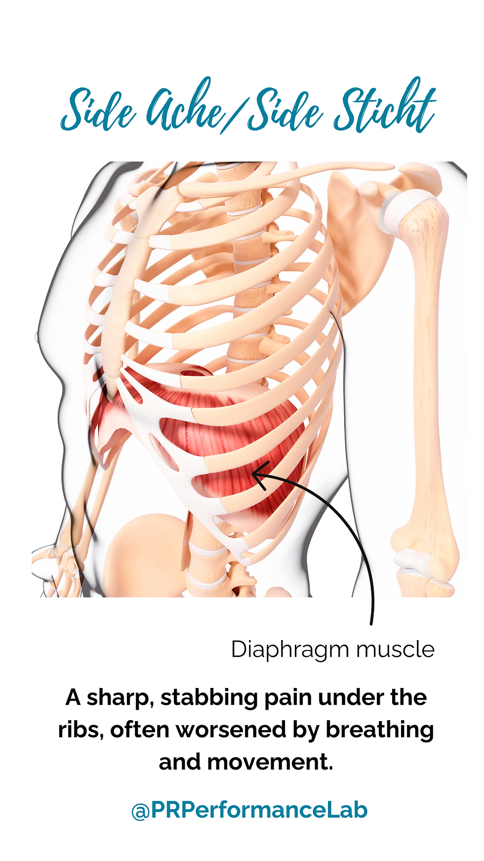 Side ache Side Sticht while running