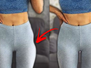 Achieving Sculpted Hips: Demystifying Hip Dips