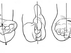 Pegada Pronada, Pegada Supinada, Pegada Neutra: Qual a diferença?