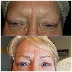 Eyebrows to dream for