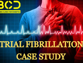 atrial fibrillation