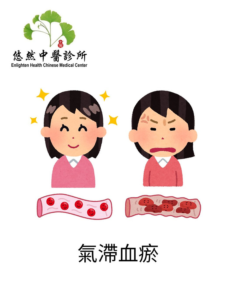 氣滯血瘀