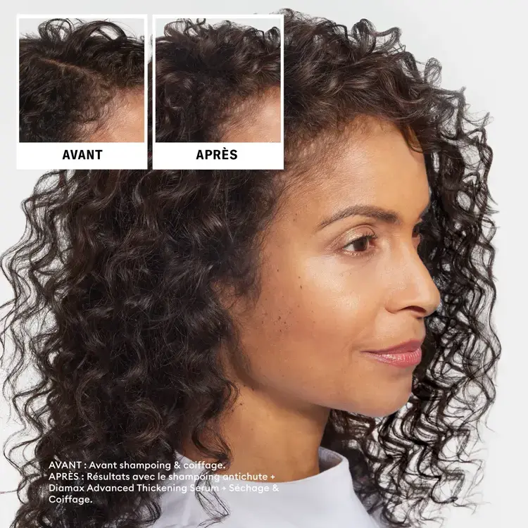 Miniature : Nioxin - Shampooing Anti chute