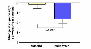 Can Psilocybin Treat Migraine Headaches?