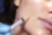 Mesotheraphy