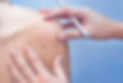 Surgical Excision
