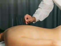 Acupuncture in the Treatment of Sports Injuries