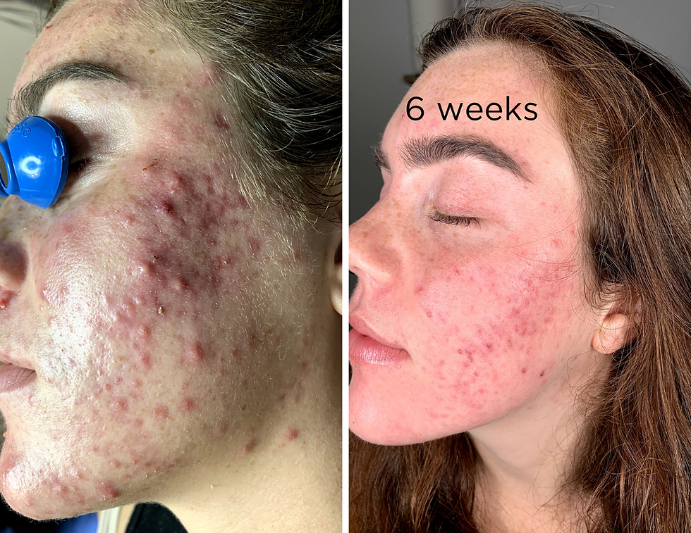 6 weeks