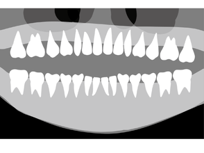歯科治療におけるレントゲンについて