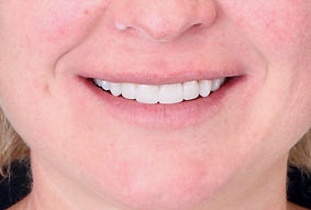 patient smile