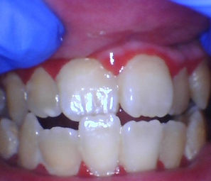 SOTA Image Exported Image 51738 Patient Solis, Bryan.jpg